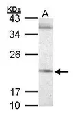 Anti-Sec61 gamma subunit antibody used in Western Blot (WB). GTX101782