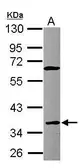 Anti-CD23 antibody [N1C3] used in Western Blot (WB). GTX101787