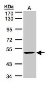 Anti-MAZ antibody [C1C3] used in Western Blot (WB). GTX101789
