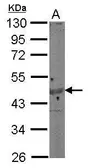 Anti-Actin Gamma 1 antibody used in Western Blot (WB). GTX101795