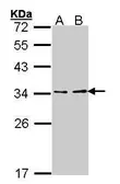Anti-ATP6V1E1 antibody [N1C3] used in Western Blot (WB). GTX101799