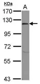 Anti-EIF3S8 antibody [C2C3], C-term used in Western Blot (WB). GTX101801
