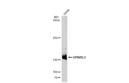 Anti-EPB41L3 antibody [C3], C-term used in Western Blot (WB). GTX101805