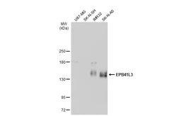 Anti-EPB41L3 antibody [C3], C-term used in Western Blot (WB). GTX101805