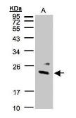 Anti-Guanylate kinase antibody used in Western Blot (WB). GTX101812