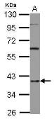 Anti-AUF1 antibody [N1C1] used in Western Blot (WB). GTX101813