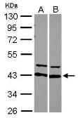 Anti-AUF1 antibody used in Western Blot (WB). GTX101814