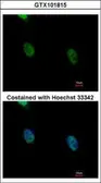 Anti-hnRNP K antibody used in Immunocytochemistry/ Immunofluorescence (ICC/IF). GTX101815