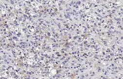 Anti-HPCAL1 antibody [N1C3] used in IHC (Paraffin sections) (IHC-P). GTX101816
