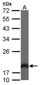 Anti-HPCAL1 antibody [N1C3] used in Western Blot (WB). GTX101816