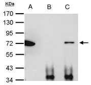 Anti-Ku70 antibody used in Immunoprecipitation (IP). GTX101820