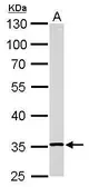Anti-RPL5 antibody used in Western Blot (WB). GTX101821