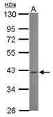 Anti-MVK antibody [N1C2] used in Western Blot (WB). GTX101822