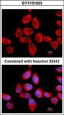 Anti-RPLP2 antibody used in Immunocytochemistry/ Immunofluorescence (ICC/IF). GTX101823