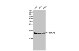 Anti-RPLP2 antibody used in Western Blot (WB). GTX101823