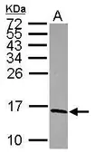 Anti-NDUFS5 antibody used in Western Blot (WB). GTX101829