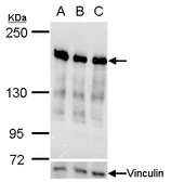 Anti-Ribosome binding protein 1 antibody [C3], C-term used in Western Blot (WB). GTX101844
