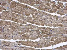 Anti-ENTPD6 antibody [N1C1] used in IHC (Paraffin sections) (IHC-P). GTX101851