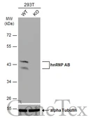 Anti-hnRNP AB antibody used in Western Blot (WB). GTX101852