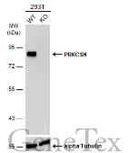 Anti-PRKCSH antibody used in Western Blot (WB). GTX101856