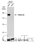 Anti-PRKCSH antibody used in Western Blot (WB). GTX101856