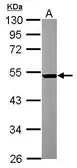 Anti-beta Tubulin 2 antibody [N1C1] used in Western Blot (WB). GTX101863