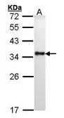 Anti-HLA-DRA antibody used in Western Blot (WB). GTX101865