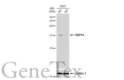 Anti-SRP14 antibody [N1C3] used in Western Blot (WB). GTX101867