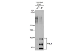 Anti-VRL1 antibody [C2C3], C-term used in Western Blot (WB). GTX101868