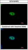 Anti-NYREN18 antibody used in Immunocytochemistry/ Immunofluorescence (ICC/IF). GTX101870