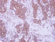 Anti-CD79b antibody used in IHC (Paraffin sections) (IHC-P). GTX101873