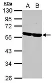 Anti-CD2 antibody [N1C1] used in Western Blot (WB). GTX101874
