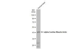 Anti-alpha Cardiac Muscle Actin antibody used in Western Blot (WB). GTX101876