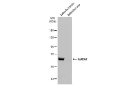 Anti-GAD67 antibody used in Western Blot (WB). GTX101881