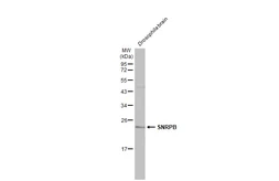 Anti-SNRPB antibody used in Western Blot (WB). GTX101883