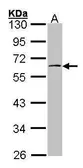 Anti-p70 S6K beta antibody [N1C1] used in Western Blot (WB). GTX101886