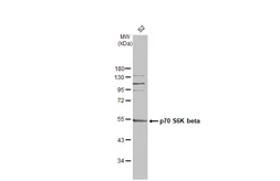 Anti-p70 S6K beta antibody used in Western Blot (WB). GTX101887