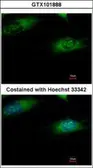 Anti-Ribophorin I antibody [C2C3], C-term used in Immunocytochemistry/ Immunofluorescence (ICC/IF). GTX101888