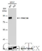 Anti-PRKCSH antibody [N1C1] used in Western Blot (WB). GTX101889