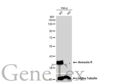 Anti-Annexin II antibody used in Western Blot (WB). GTX101902