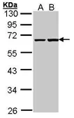 Anti-PHF1 antibody [N1N3] used in Western Blot (WB). GTX101904