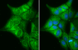 Anti-Cytochrome b5 antibody [N1C3] used in Immunocytochemistry/ Immunofluorescence (ICC/IF). GTX101909