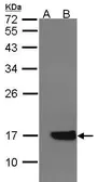 Anti-Cytochrome b5 antibody [N1C3] used in Western Blot (WB). GTX101909