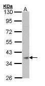 Anti-alpha Skeletal Muscle Actin antibody used in Western Blot (WB). GTX101920