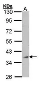 Anti-alpha Skeletal Muscle Actin antibody used in Western Blot (WB). GTX101920