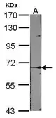 Anti-ACVRL1 antibody [N2C1], Internal used in Western Blot (WB). GTX101921