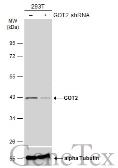 Anti-GOT2 antibody used in Western Blot (WB). GTX101929