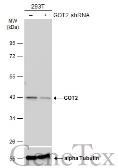 Anti-GOT2 antibody used in Western Blot (WB). GTX101930