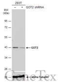 Anti-GOT2 antibody used in Western Blot (WB). GTX101930