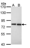 Anti-EXT2 antibody [N3C2], Internal used in Western Blot (WB). GTX101934